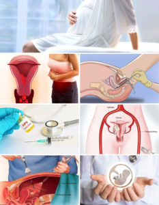 Gynecology Services