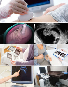 Ultra Sonography